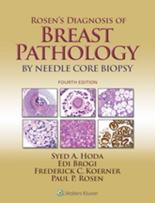 Cover of the book Rosen's Diagnosis of Breast Pathology by Needle Core Biopsy by Syed A. Hoda, Paul Peter Rosen, Edi Brogi, Frederick C. Koerner, Wolters Kluwer Health