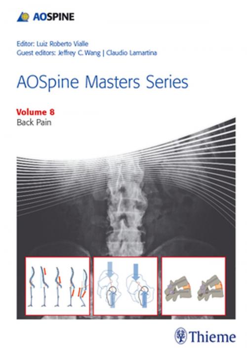 Cover of the book AOSpine Masters Series, Volume 8: Back Pain by , Thieme