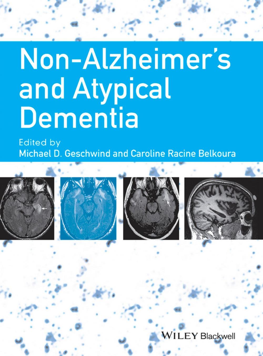 Big bigCover of Non-Alzheimer's and Atypical Dementia