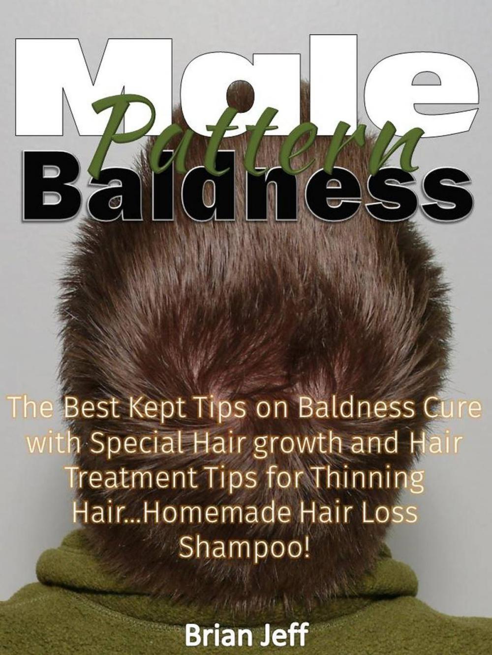 Big bigCover of Male Pattern Baldness: The Best Kept Tips on Baldness Cure with Special Hair growth and Hair Treatment Tips for Thinning Hair...Homemade Hair Loss Shampoo!