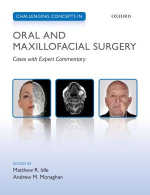 Cover of the book Challenging Concepts in Oral and Maxillofacial Surgery by Thomas De Quincey