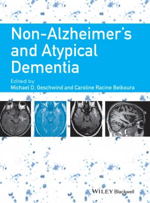 Cover of the book Non-Alzheimer's and Atypical Dementia by Dr. Dehong Huo