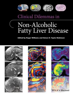 Cover of the book Clinical Dilemmas in Non-Alcoholic Fatty Liver Disease by Ingvar Eidhammer, Harald Barsnes, Geir Egil Eide, Lennart Martens