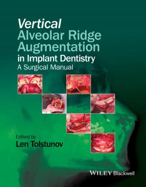 Cover of the book Vertical Alveolar Ridge Augmentation in Implant Dentistry by 