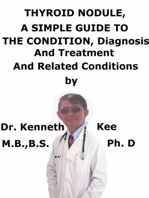 Book cover of Thyroid Nodule, A Simple Guide To The Condition, Diagnosis, Treatment And Related Conditions