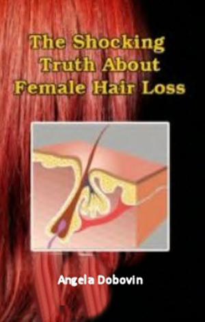 Cover of the book The Shocking Truth About Female Hair Loss by Ashley James
