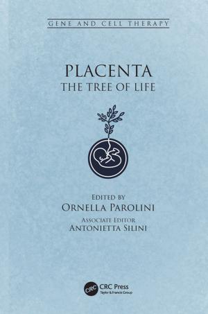 Cover of the book Placenta by Glen D. Gillen, Katharina Gillen, Shekhar Guha