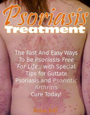 Cover of Psoriasis Treatment: The Fast and Easy Ways to Be Psoriasis Free for Life... with Special Tips for Guttate Psoriasis and Psoriatic Arthritis Cure Today!