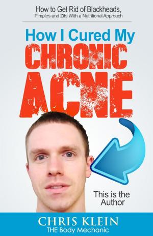 Book cover of How I Cured My Chronic Acne: How to Get Rid of Blackheads, Pimples and Zits With a Nutritional Approach