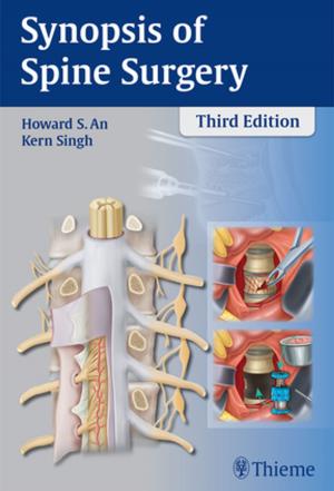 Cover of the book Synopsis of Spine Surgery by Manfred Thelen, Raimund Erbel, Karl-Friedrich Kreitner