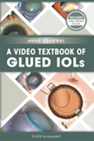 Cover of A Video Textbook of Glued IOLs