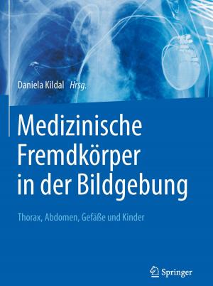 Cover of the book Medizinische Fremdkörper in der Bildgebung by Jörg Schmal