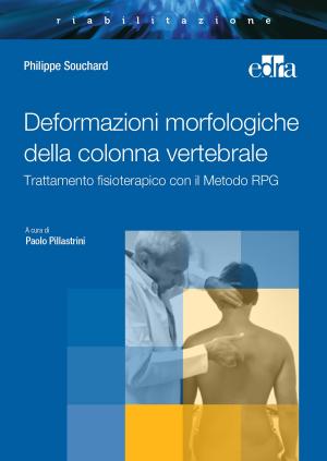 Cover of the book Deformazioni morfologiche della colonna vertebrale by Philippe Souchard