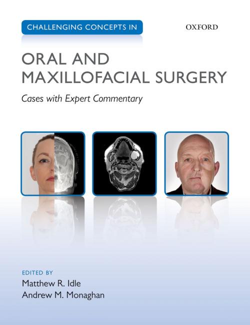Cover of the book Challenging Concepts in Oral and Maxillofacial Surgery by , OUP Oxford