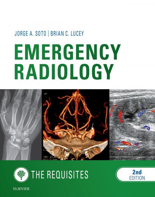 Cover of the book Emergency Radiology: The Requisites E-Book by Jorge A Soto, MD, Brian C Lucey, MD, Elsevier Health Sciences