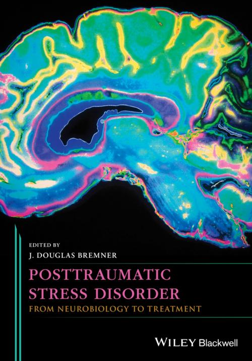 Cover of the book Posttraumatic Stress Disorder by J. Douglas Bremner, Wiley