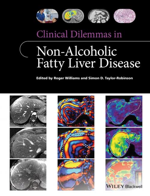 Cover of the book Clinical Dilemmas in Non-Alcoholic Fatty Liver Disease by Roger Williams, Simon D. Taylor-Robinson, Wiley