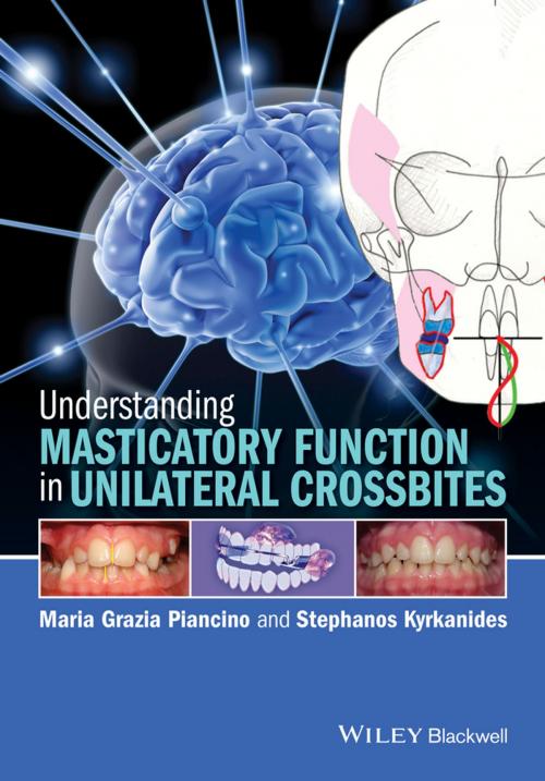Cover of the book Understanding Masticatory Function in Unilateral Crossbites by Stephanos Kyrkanides, Maria Grazia Piancino, Wiley