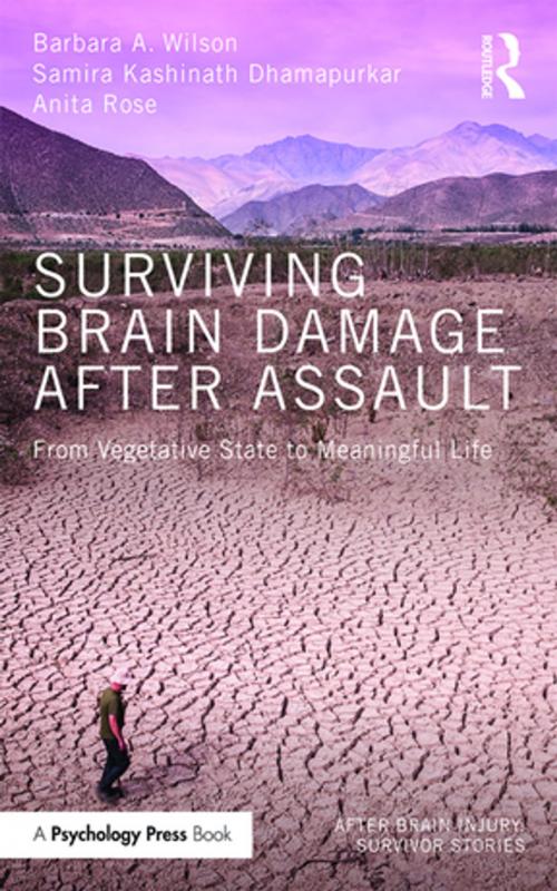 Cover of the book Surviving Brain Damage After Assault by Barbara A. Wilson, Samira Kashinath Dhamapurkar, Anita Rose, Taylor and Francis