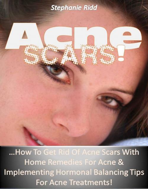 Cover of the book Acne Scars! …How to Get Rid of Acne Scars with Home Remedies for Acne & Implementing Hormonal Balancing Tips for Acne Treatments! by Stephanie Ridd, Eljays-epublishing