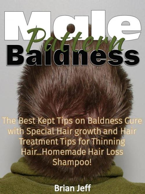 Cover of the book Male Pattern Baldness: The Best Kept Tips on Baldness Cure with Special Hair growth and Hair Treatment Tips for Thinning Hair...Homemade Hair Loss Shampoo! by Brian Jeff, Eljays-epublishing