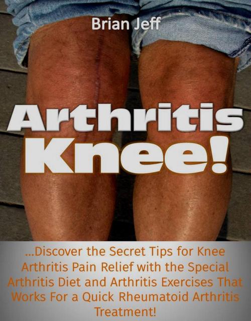 Cover of the book Arthritis Knee! …Discover the Secret Tips for Knee Arthritis Pain Relief with the Special Arthritis Diet and Arthritis Exercises That Works For a Quick Rheumatoid Arthritis Treatment! by Brian Jeff, Eljays-epublishing