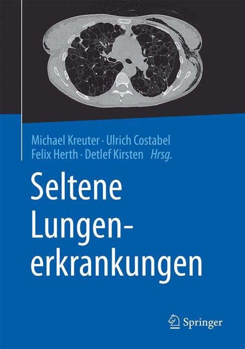 Cover of the book Seltene Lungenerkrankungen by , Springer Berlin Heidelberg