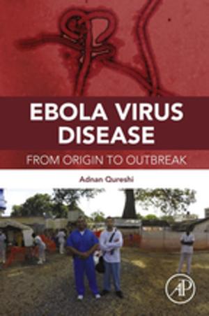 Book cover of Ebola Virus Disease