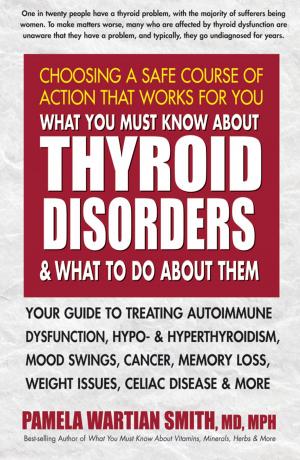 Cover of the book What You Must Know About Thyroid Disorders and What to Do About Them by Glenn Doman, Janet Doman