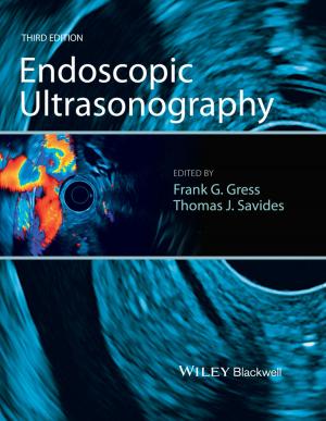 Cover of the book Endoscopic Ultrasonography by Stephen Westland, Caterina Ripamonti, Vien Cheung