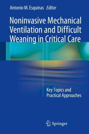 Cover of the book Noninvasive Mechanical Ventilation and Difficult Weaning in Critical Care by Victor N. Cherepanov, Yulia N. Kalugina, Mikhail A. Buldakov