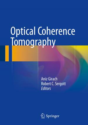 Cover of the book Optical Coherence Tomography by Sergei Petrenko