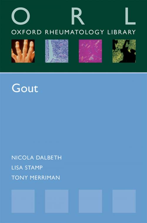 Cover of the book Gout by Nicola Dalbeth, Lisa Stamp, Tony Merriman, OUP Oxford