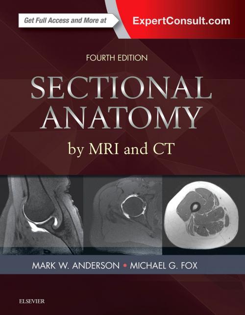 Cover of the book Sectional Anatomy by MRI and CT E-Book by Mark W. Anderson, MD, Michael G Fox, MD, Elsevier Health Sciences