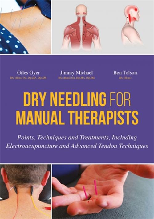 Cover of the book Dry Needling for Manual Therapists by Giles Gyer, Jimmy Michael, Ben Tolson, Jessica Kingsley Publishers