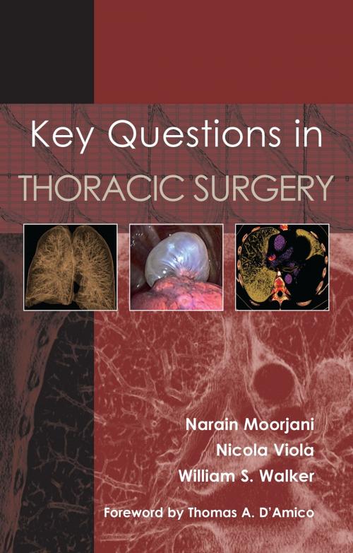 Cover of the book Key Questions in Thoracic Surgery by Narain Moorajni, Nicola Viola, William S. Walker, tfm Publishing Ltd