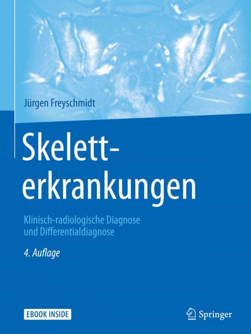 Cover of the book Skeletterkrankungen by Jürgen Freyschmidt, Springer Berlin Heidelberg