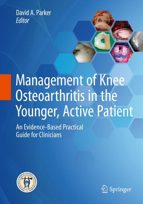Cover of the book Management of Knee Osteoarthritis in the Younger, Active Patient by , Springer Berlin Heidelberg
