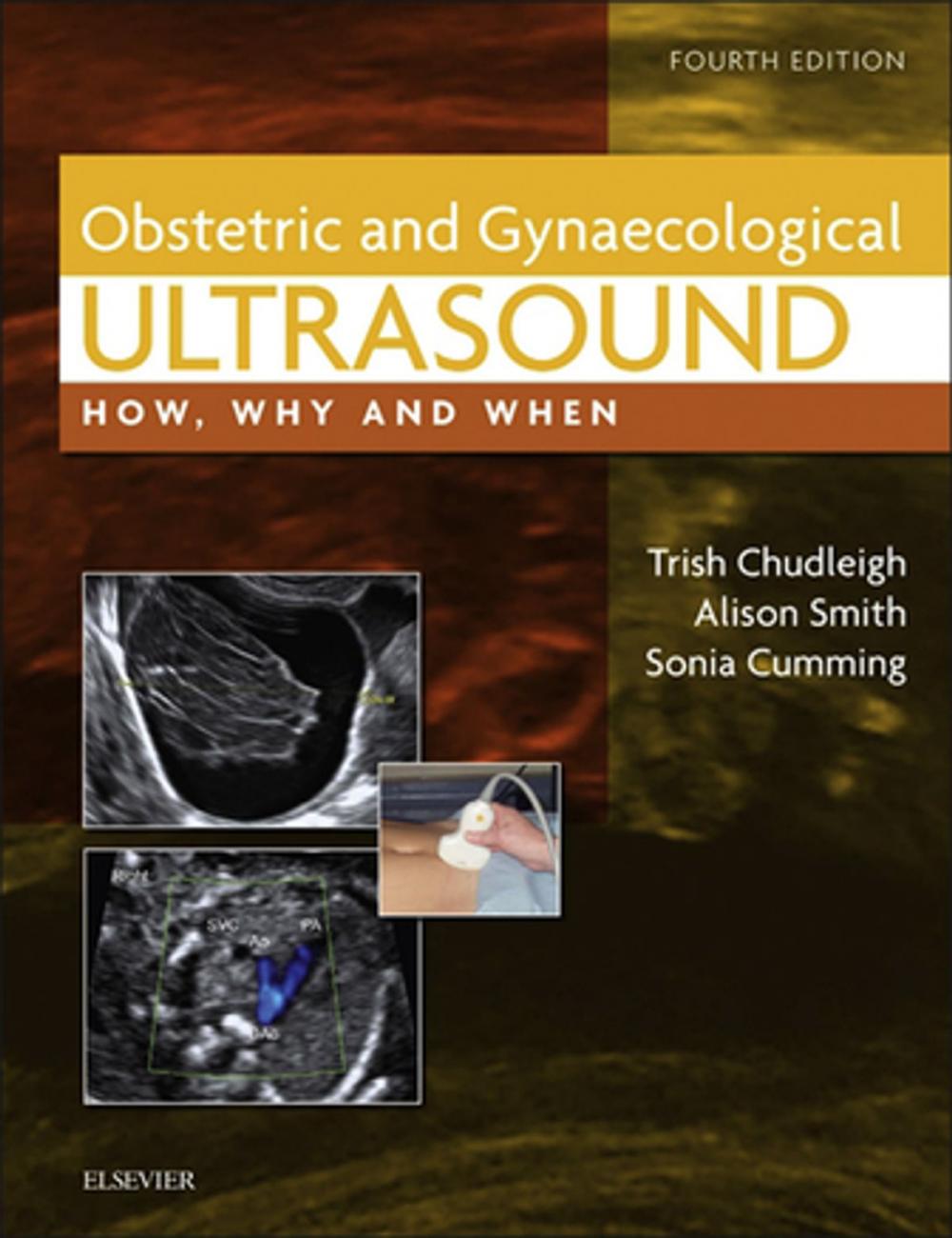 Big bigCover of Obstetric & Gynaecological Ultrasound E-Book