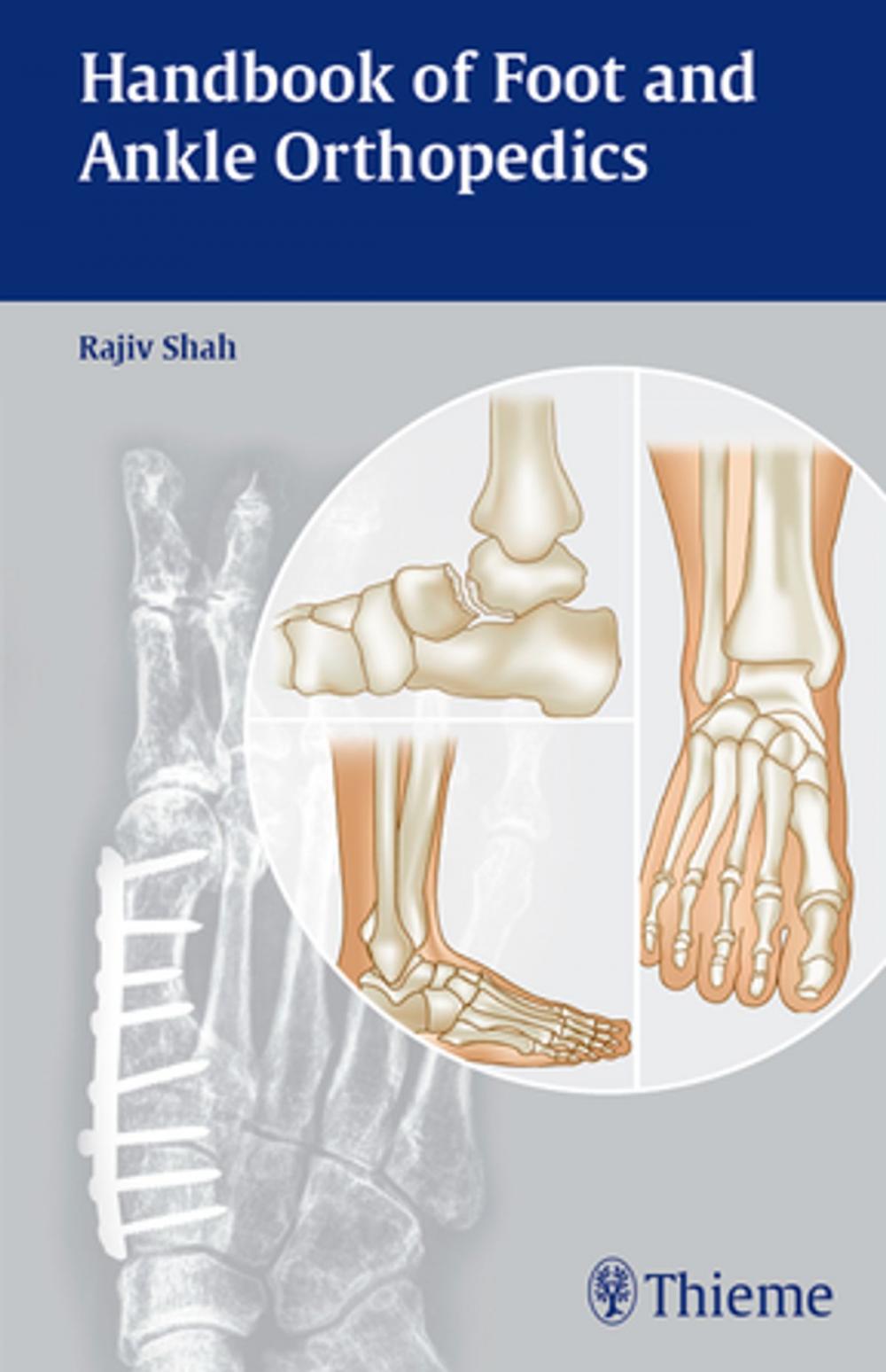 Big bigCover of Handbook of Foot and Ankle Orthopedics