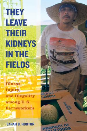 Cover of the book They Leave Their Kidneys in the Fields by Joyce Goldstein
