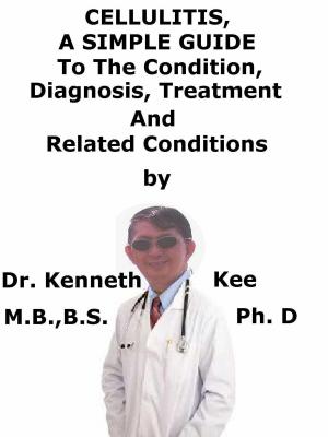 Cover of the book Cellulitis, A Simple Guide To The Condition, Diagnosis, Treatment And Related Conditions by Kenneth Kee