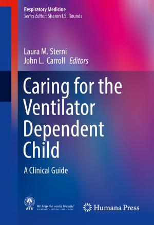 Cover of the book Caring for the Ventilator Dependent Child by Nobuyuki Yajima, Naoki Izutsu, Takeshi Imamura, Toyoo Abe