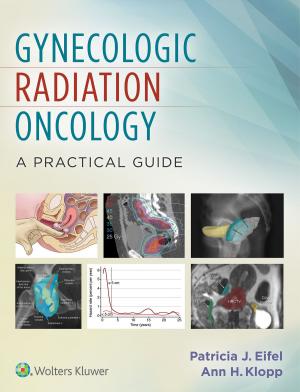 bigCover of the book Gynecologic Radiation Oncology: A Practical Guide by 