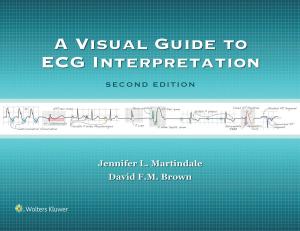 Book cover of A Visual Guide to ECG Interpretation
