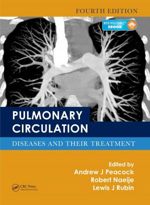 Cover of the book Pulmonary Circulation by Ajaya Kumar Gupta