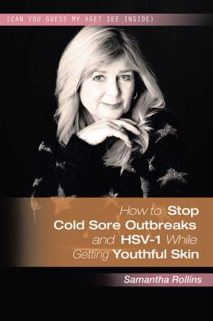 Cover of the book How to Stop Cold Sore Outbreaks and Hsv-1 While Getting Youthful Skin by Guy McBride