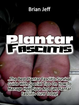 bigCover of the book Plantar Fasciitis: The Best Plantar Fasciitis Survival Guide With Special Tips On How To Manage Heel Spur And Get Plantar Fasciitis Cure Today! by 