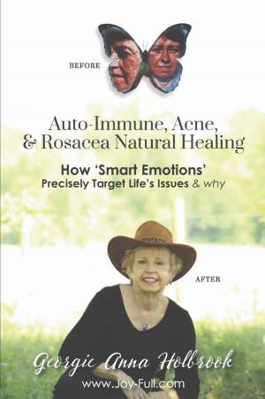 Cover of the book Auto-Immune, Acne, & Rosacea Natural Healing - How 'Smart Emotions' Precisely Target Life's Issues & Why by Terry J. Logan