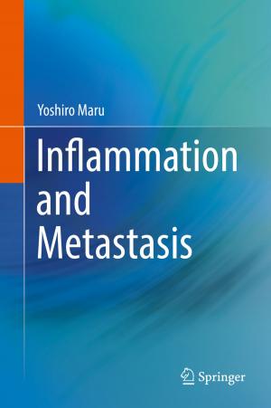 Book cover of Inflammation and Metastasis